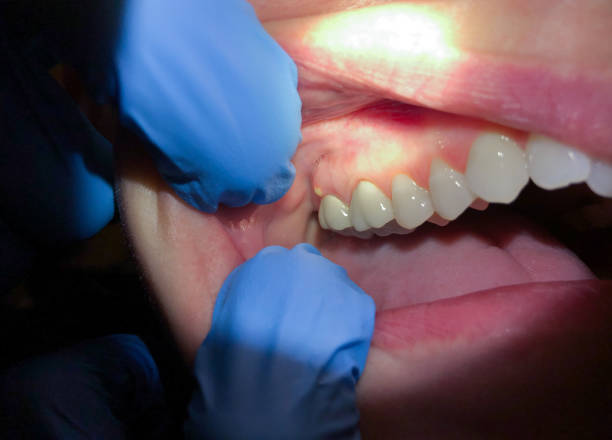 Best Same-Day Emergency Dentist in Pierre Part, LA